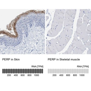 Anti-PERP antibody produced in rabbit Prestige Antibodies&#174; Powered by Atlas Antibodies, affinity isolated antibody, buffered aqueous glycerol solution