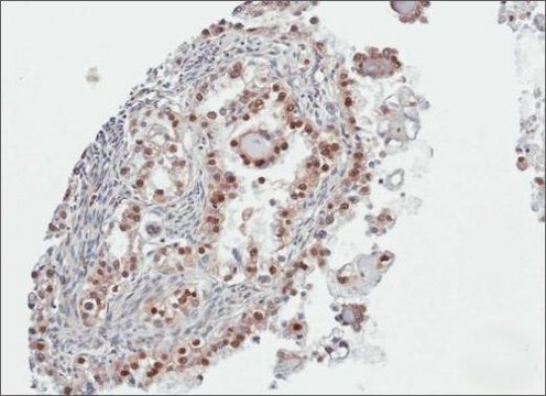 Anti-PARP3 antibody produced in rabbit