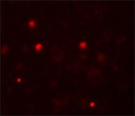 Anti-KCNK13 antibody produced in rabbit affinity isolated antibody