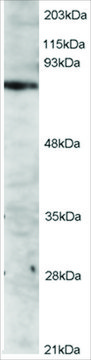 Anti-ITK antibody produced in goat affinity isolated antibody, buffered aqueous solution