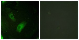 Anti-IREB1 antibody produced in rabbit affinity isolated antibody