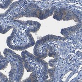 Anti-DSC1 antibody produced in rabbit Prestige Antibodies® Powered by Atlas Antibodies, affinity isolated antibody, buffered aqueous glycerol solution