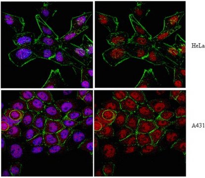 Anti-Axin-1 Antibody from rabbit, purified by affinity chromatography