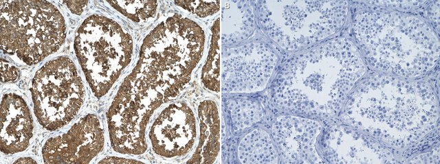 Anti-GATA4 Antibody, clone 1K15 ZooMAb&#174; Rabbit Monoclonal recombinant, expressed in HEK 293 cells