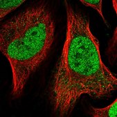 Anti-NACC1 antibody produced in rabbit Prestige Antibodies® Powered by Atlas Antibodies, affinity isolated antibody, buffered aqueous glycerol solution