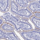 Anti-ENPP3 antibody produced in rabbit Prestige Antibodies® Powered by Atlas Antibodies, affinity isolated antibody, buffered aqueous glycerol solution