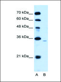 Anti-PPAP2A (AB1) antibody produced in rabbit IgG fraction of antiserum
