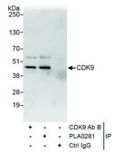 Rabbit anti-CDK9 Antibody, Affinity Purified Powered by Bethyl Laboratories, Inc.