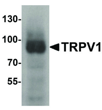 Anti-TRPV1 antibody produced in rabbit affinity isolated antibody