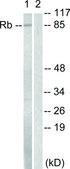 Anti-Retinoblastoma antibody produced in rabbit affinity isolated antibody