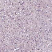 Anti-TMEM231 antibody produced in rabbit Prestige Antibodies® Powered by Atlas Antibodies, affinity isolated antibody, buffered aqueous glycerol solution