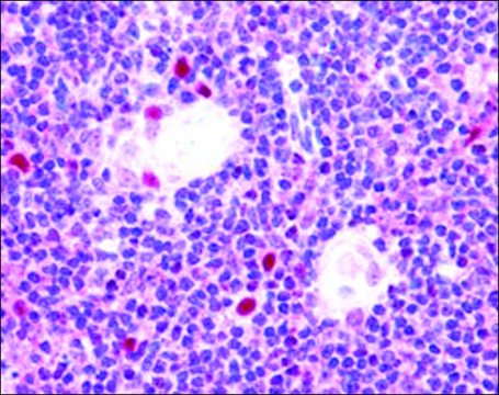 Anti-AIRE (Isoform 1) antibody produced in goat affinity isolated antibody, buffered aqueous solution