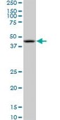 Monoclonal Anti-NODAL, (C-terminal) antibody produced in mouse clone 5C3, purified immunoglobulin, buffered aqueous solution