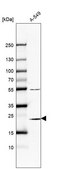 Anti-PSMB6 antibody produced in rabbit Prestige Antibodies® Powered by Atlas Antibodies, affinity isolated antibody