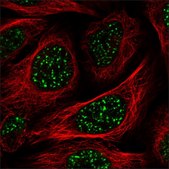 Anti-KDM6B antibody produced in rabbit Prestige Antibodies® Powered by Atlas Antibodies, affinity isolated antibody, buffered aqueous glycerol solution