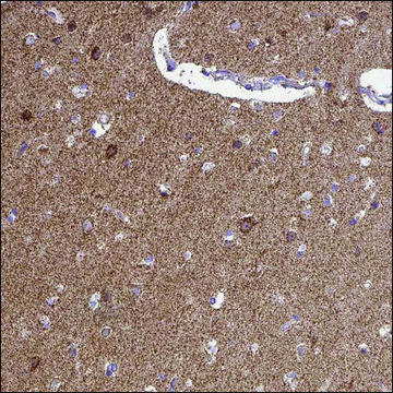 Anti-SRRM4 antibody produced in rabbit Prestige Antibodies&#174; Powered by Atlas Antibodies, affinity isolated antibody, buffered aqueous glycerol solution