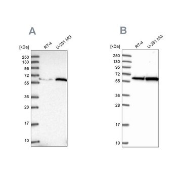 Anti-KPNA4 antibody produced in rabbit Prestige Antibodies&#174; Powered by Atlas Antibodies, affinity isolated antibody, buffered aqueous glycerol solution