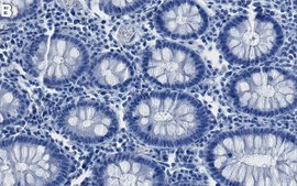 Anti-PDI Antibody, clone 1M19 ZooMAb&#174; Rabbit Monoclonal recombinant, expressed in HEK 293 cells