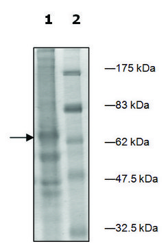 Ceramide Kinase FLAG tag active human recombinant, expressed in baculovirus infected Sf9 cells, &#8805;40% (SDS-PAGE)