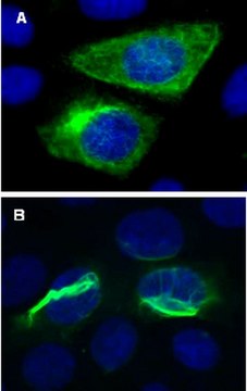 LentiBrite GFP-Vimentin Lentiviral Biosensor