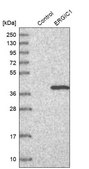 Anti-ERGIC1 antibody produced in rabbit Prestige Antibodies® Powered by Atlas Antibodies, affinity isolated antibody, buffered aqueous glycerol solution, Ab2