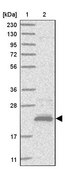 Anti-MOSPD1 antibody produced in rabbit Prestige Antibodies® Powered by Atlas Antibodies, affinity isolated antibody, buffered aqueous glycerol solution