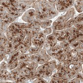 Anti-GPC3 antibody produced in mouse Prestige Antibodies® Powered by Atlas Antibodies, clone CL12711, purified by using Protein A, buffered aqueous glycerol solution