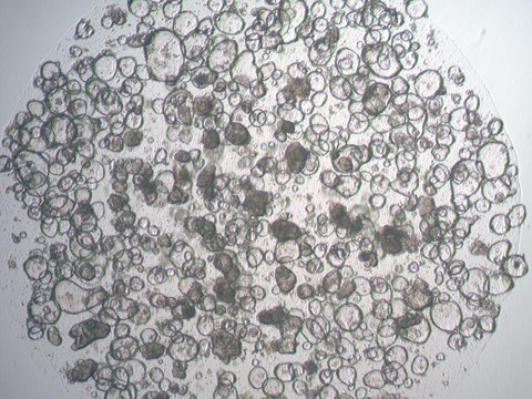 3dGRO Colon Rectum Intestinal Organoids, Age 23 (Prep ht-208-CR-CR)