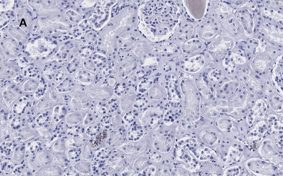 Anti-HSP60 Antibody, clone 1N3, ZooMAb&#174; Rabbit Monoclonal recombinant, expressed in HEK 293 cells