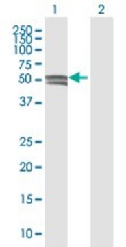 Anti-GCNT1 antibody produced in mouse purified immunoglobulin, buffered aqueous solution