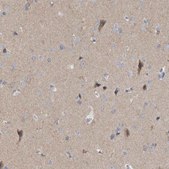 Anti-GDAP1 antibody produced in rabbit Prestige Antibodies® Powered by Atlas Antibodies, affinity isolated antibody, buffered aqueous glycerol solution