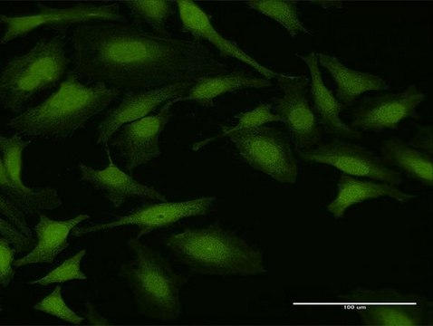 Anti-NUDT5 antibody produced in rabbit purified immunoglobulin, buffered aqueous solution