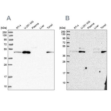 Anti-ZDHHC16 antibody produced in rabbit Prestige Antibodies&#174; Powered by Atlas Antibodies, affinity isolated antibody, buffered aqueous glycerol solution