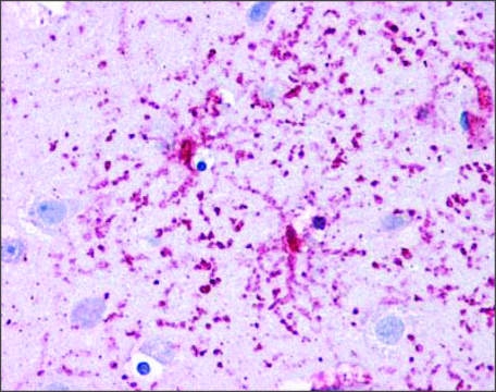 Anti-GLUD1 affinity isolated antibody