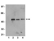 MAPK Pathway 1 Explorer Antibody MiniPack clone AW39R, 1 mg/mL (05-538SP), Upstate®
