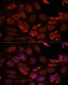 Anti-GIT1 antibody produced in rabbit