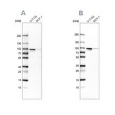 Anti-ENAH antibody produced in rabbit Prestige Antibodies® Powered by Atlas Antibodies, affinity isolated antibody, buffered aqueous glycerol solution, ab2