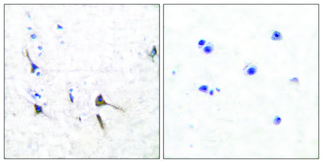 Anti-Potassium Channel Kv3.2b antibody produced in rabbit affinity isolated antibody