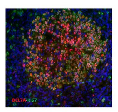 Anti-BCL7A Antibody, clone 15C clone 15C, from mouse