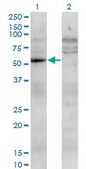 Monoclonal Anti-UMPS antibody produced in mouse clone 2F5, purified immunoglobulin, buffered aqueous solution