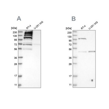 Anti-C1orf112 antibody produced in rabbit Prestige Antibodies&#174; Powered by Atlas Antibodies, affinity isolated antibody, buffered aqueous glycerol solution, Ab2