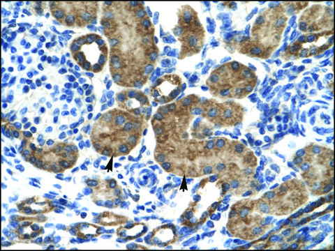 Anti-GRIK2 (AB2) antibody produced in rabbit IgG fraction of antiserum