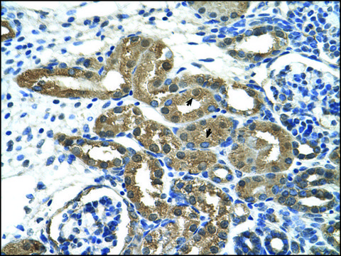 抗-HDAC9 兔抗 IgG fraction of antiserum