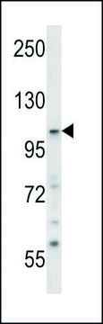 ANTI-SNX14 (CENTER) antibody produced in rabbit IgG fraction of antiserum, buffered aqueous solution