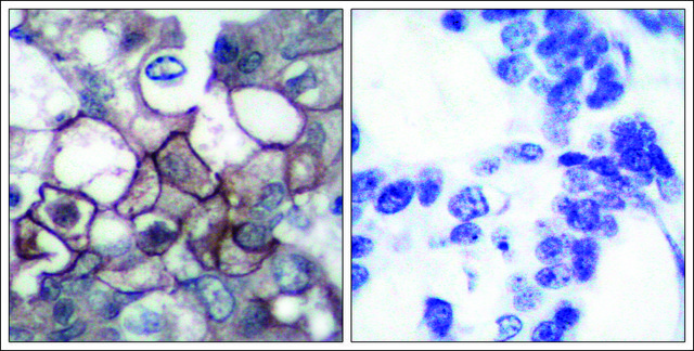 Anti-phospho-EGFR (pTyr1197) antibody produced in rabbit affinity isolated antibody