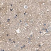 Anti-DCAF7 antibody produced in rabbit Prestige Antibodies® Powered by Atlas Antibodies, affinity isolated antibody, buffered aqueous glycerol solution, Ab1