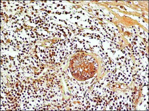 Anti-acetyl-Histone H3 (Ac-Lys27) antibody produced in rabbit ~1.0&#160;mg/mL, affinity isolated antibody