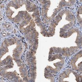 Anti-TAPBPL antibody produced in rabbit Prestige Antibodies® Powered by Atlas Antibodies, affinity isolated antibody, buffered aqueous glycerol solution