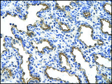 Anti-MUC1 (AB2) antibody produced in rabbit IgG fraction of antiserum