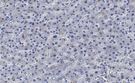 Anti-Haptoglobin Antibody, clone 2D22 ZooMAb® Rabbit Monoclonal recombinant, expressed in HEK 293 cells